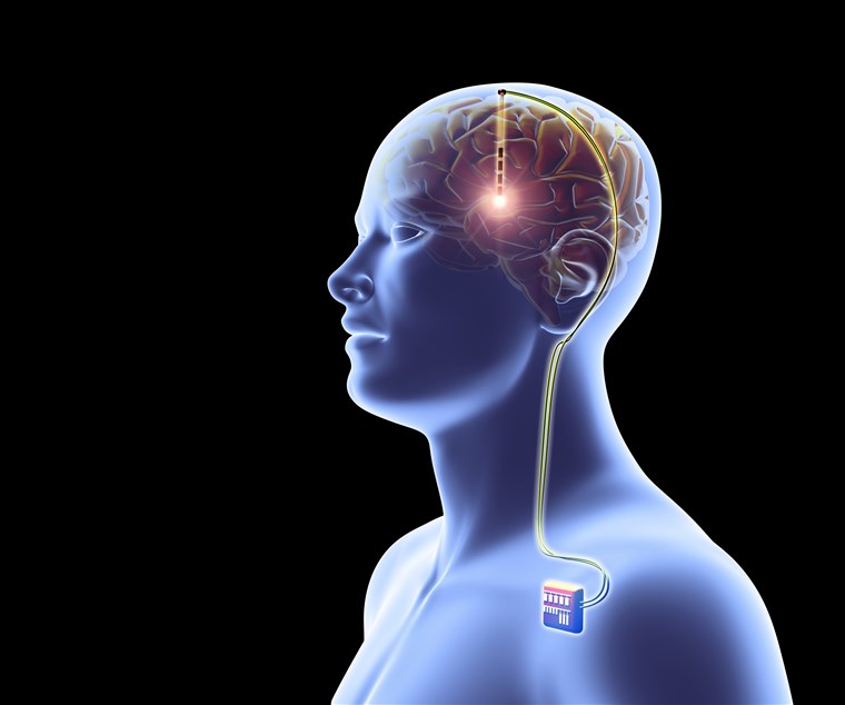 Neuroscience Technologies Capable of Tracking Human Mind to stop Brain Injury